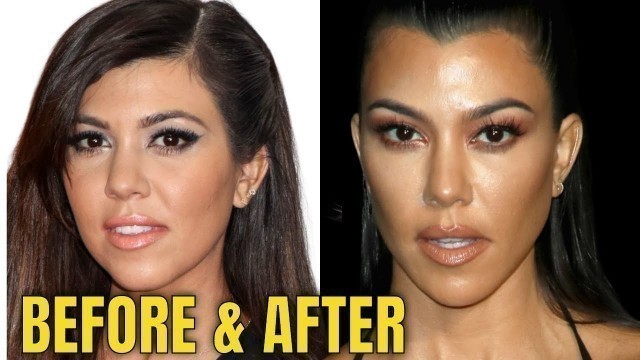 'Kourtney Kardashian: Plastic Surgery: Is She Trying to Look Like Kim?'