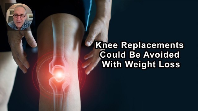 'There\'s A Whole Lot Of Knee Replacements We Could Avoid If We Got People To Lose Weight'