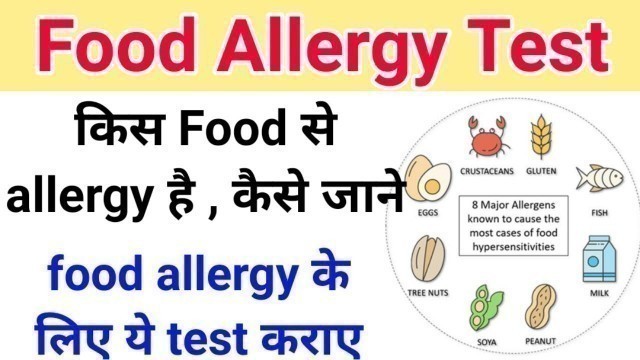 'किस food से allergy है कैसे जाने || Food allergy test - Lactose , MSG , Gluten'