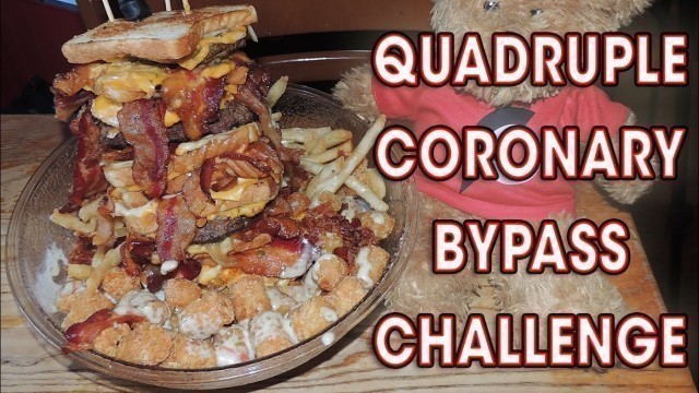 'Vortex\'s CORONARY BYPASS Burger Challenge!!'