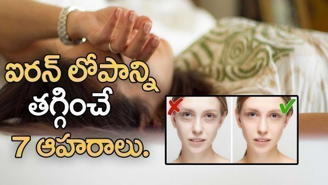 'Iron Deficiency Problem Telugu I రక్తహీనత I Health Benefits Of Iron Food | Health Tips In Telugu'