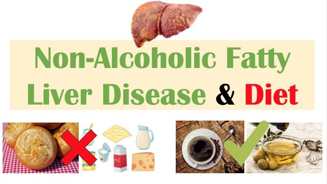 'Non-Alcoholic Fatty Liver Disease & Diet | Diets to Prevent and Reduce Severity of NAFLD'