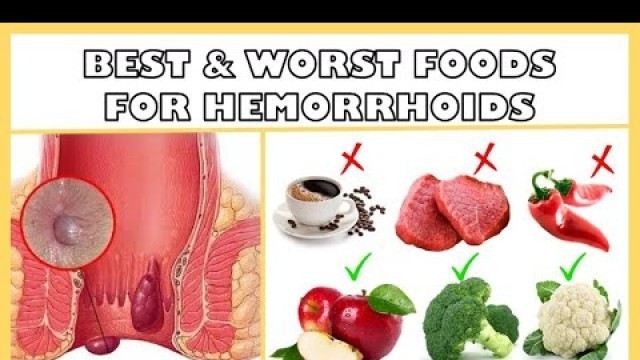 'Best & Worst Foods For Hemorrhoids :- Hemorrhoids Diet [What You Should & Shouldn\'t Eat]'